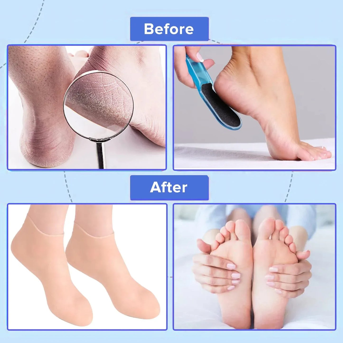 Silicone Gel Moisturizing Sock Prevent Foot Heel Crack Shoes
